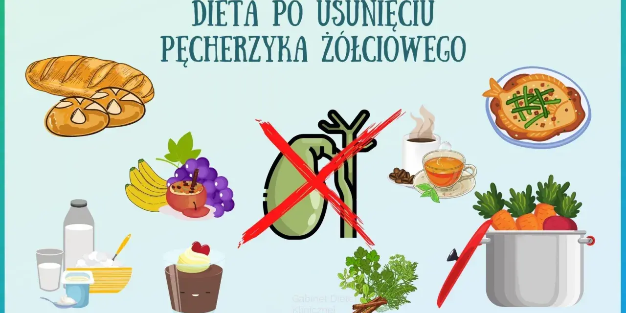 Ilustracja przedstawia produkty zalecane i niewskazane w diecie po usunięciu woreczka żółciowego: pieczywo, owoce, nabiał, deser, rybę, warzywa, kawę i herbatę.