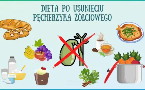 Ilustracja przedstawia produkty zalecane i niewskazane w diecie po usunięciu woreczka żółciowego: pieczywo, owoce, nabiał, deser, rybę, warzywa, kawę i herbatę.