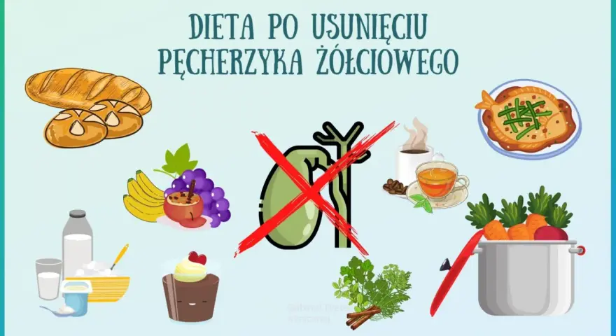 Ilustracja przedstawia produkty zalecane i niewskazane w diecie po usunięciu woreczka żółciowego: pieczywo, owoce, nabiał, deser, rybę, warzywa, kawę i herbatę.